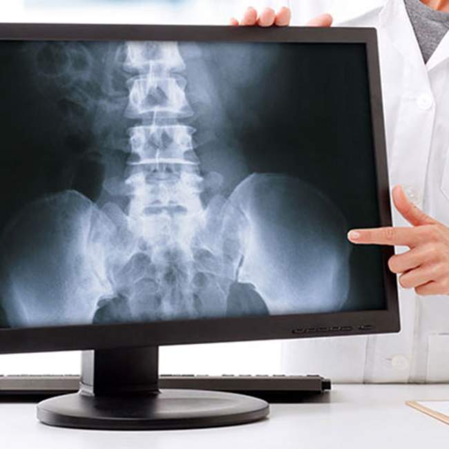 Orthopädie Calw - Röntgendiagnostik Orthopädie Calw - Röntgendiagnostik